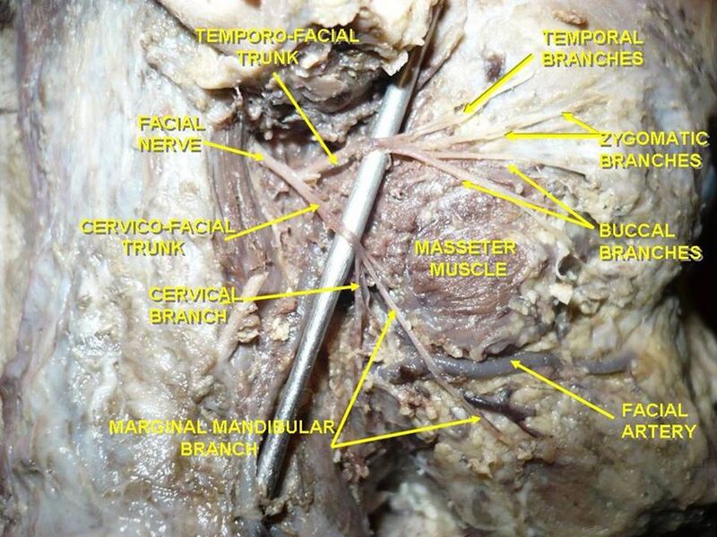 File:Slide2umr.JPG