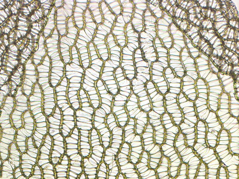 File:Sphagnum cells.jpg