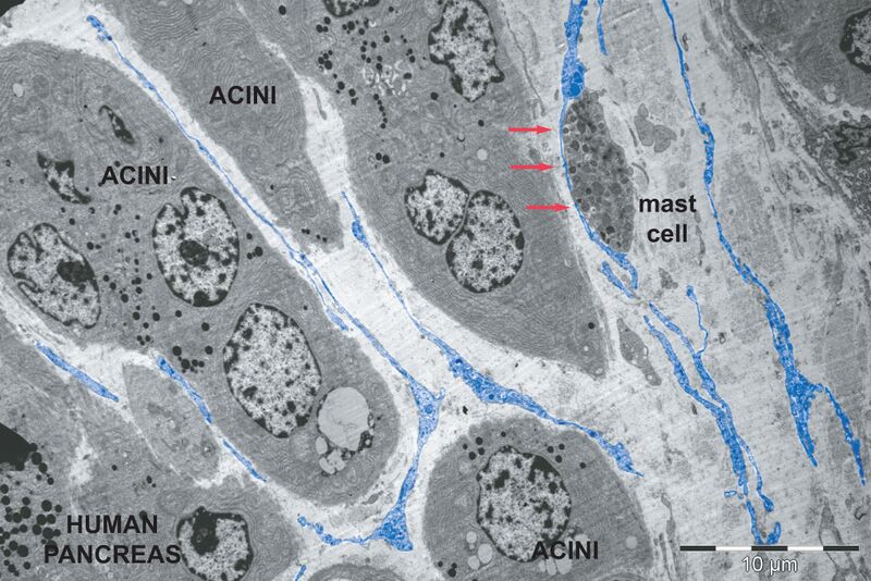 File:Telocytes - Fig 3.jpg