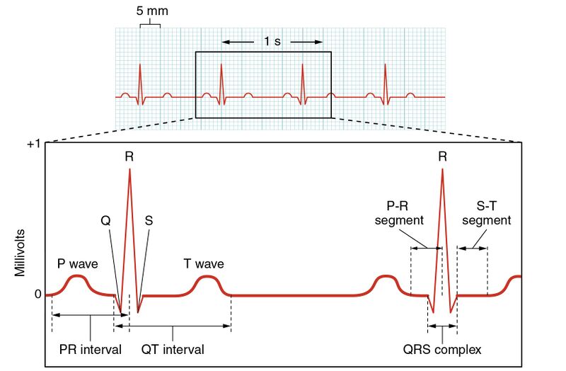 File:2022 Electrocardiogram.jpg