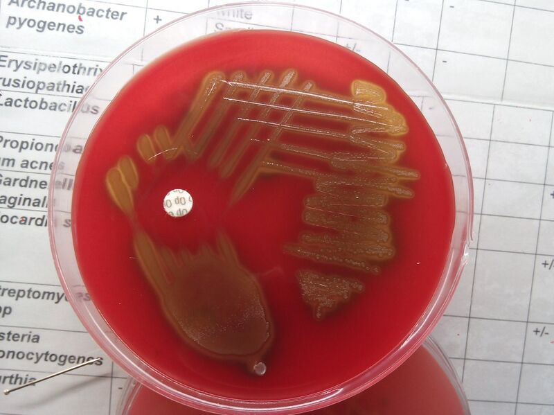 File:S. pneumoniae.jpg