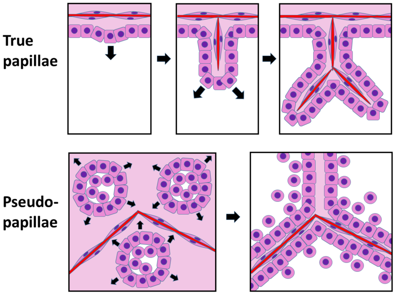 File:Papillae vs pseudopapillae.png