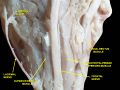 Levator palpebrae superioris muscle