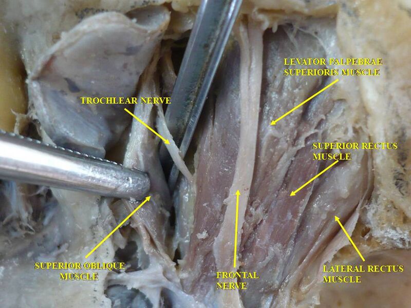 File:Slide2ior.JPG