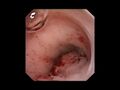 Thumbnail for version as of 01:22, 2 June 2026