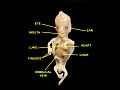 Umbilical vein