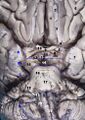 Interpeduncular fossa
