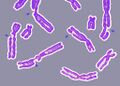 Broken Chromosome