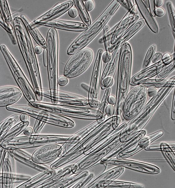 File:Chironex fleckeri nematocysts 01.jpg