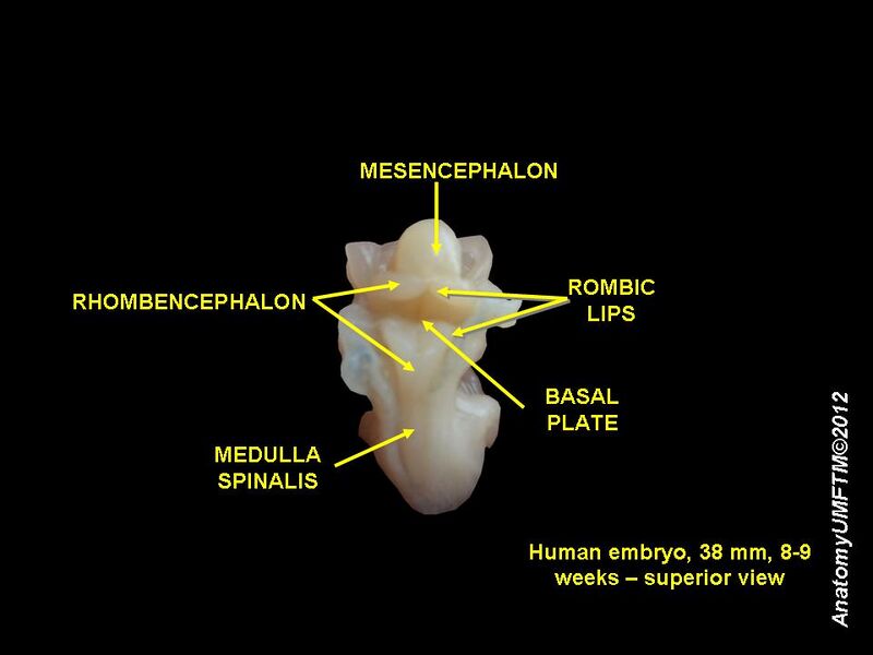 File:Human embryo 8 weeks 9.JPG