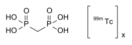 File:Tc-99m medronic acid skeletal.svg