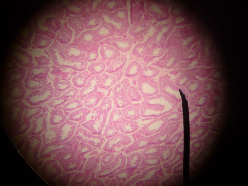 File:Seminiferous tubule.JPG