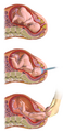 Thumbnail for version as of 03:22, 5 June 2026
