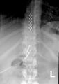 Thumbnail for version as of 13:40, 8 June 2026
