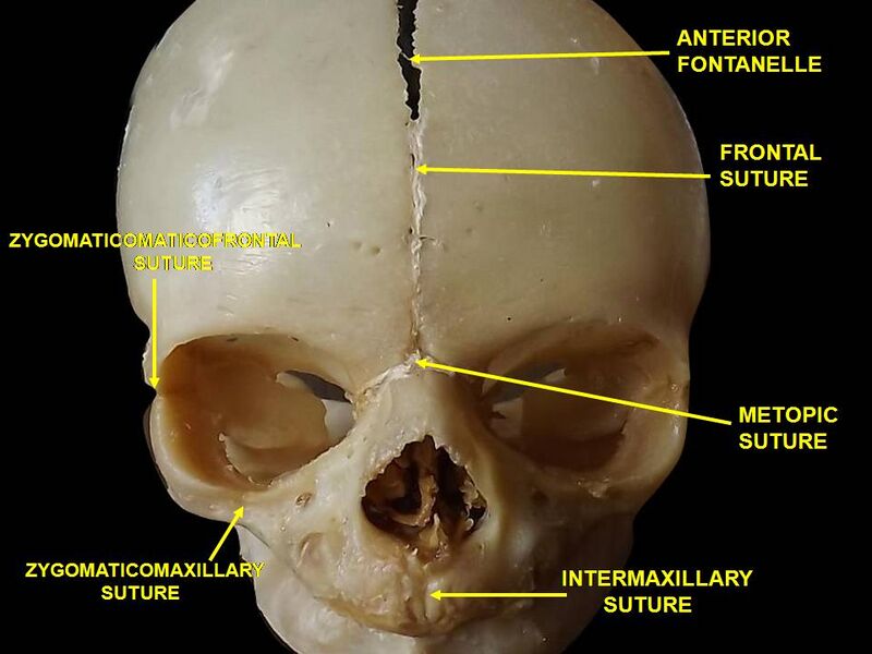 File:Slide1MIA.JPG