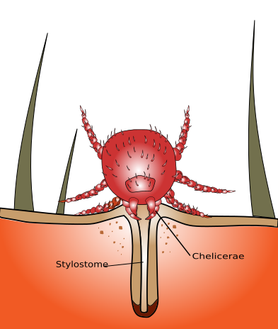 File:Chigger bite.svg