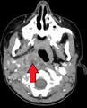 Thumbnail for version as of 22:34, 8 June 2026