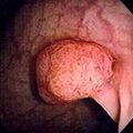 Thumbnail for version as of 03:19, 5 June 2026