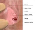 Skenes gland