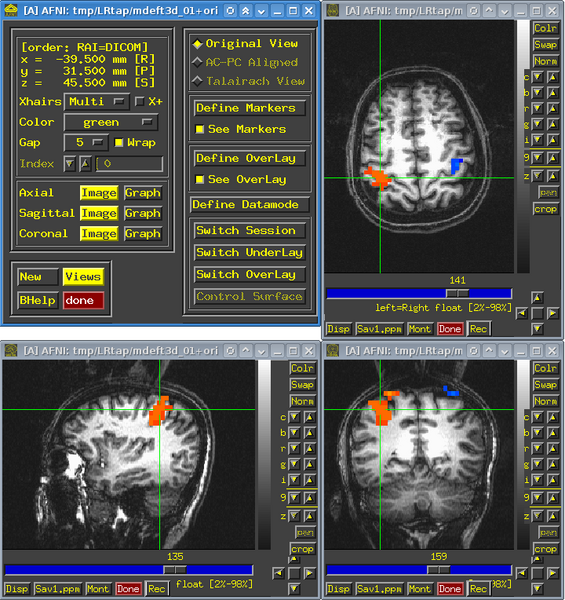 File:AFNI screenshot.png