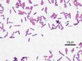 Bacillus subtilis Gram stain