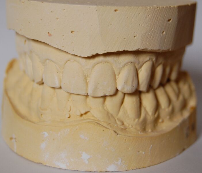 File:Toothmold.jpg