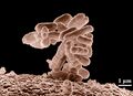 E. coli at 10000x Magnification