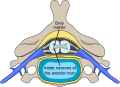 Polio spinal diagram