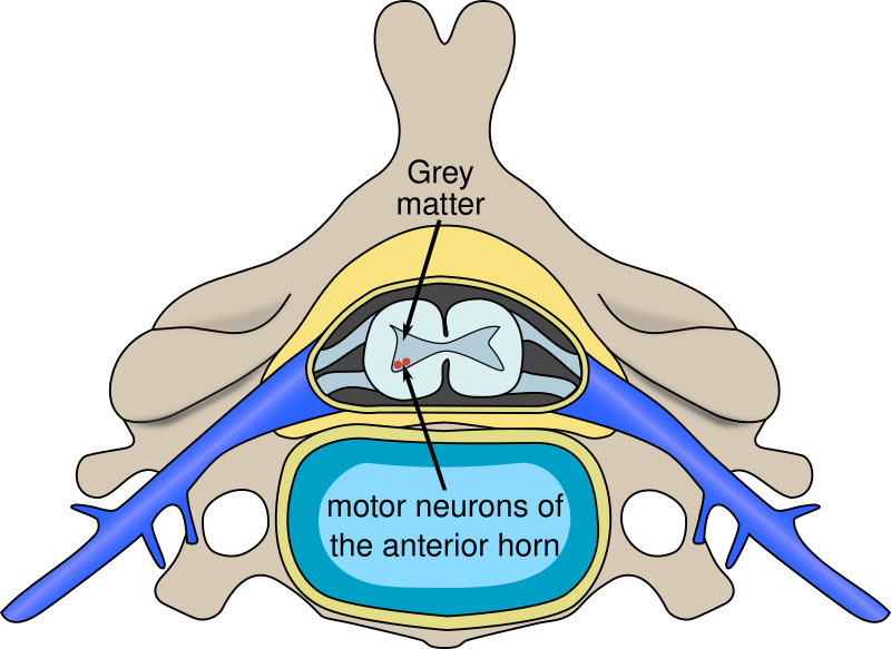 File:Polio spinal diagram-en.svg