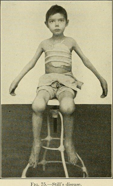 File:Diseases of children (1916) (14579765477).jpg