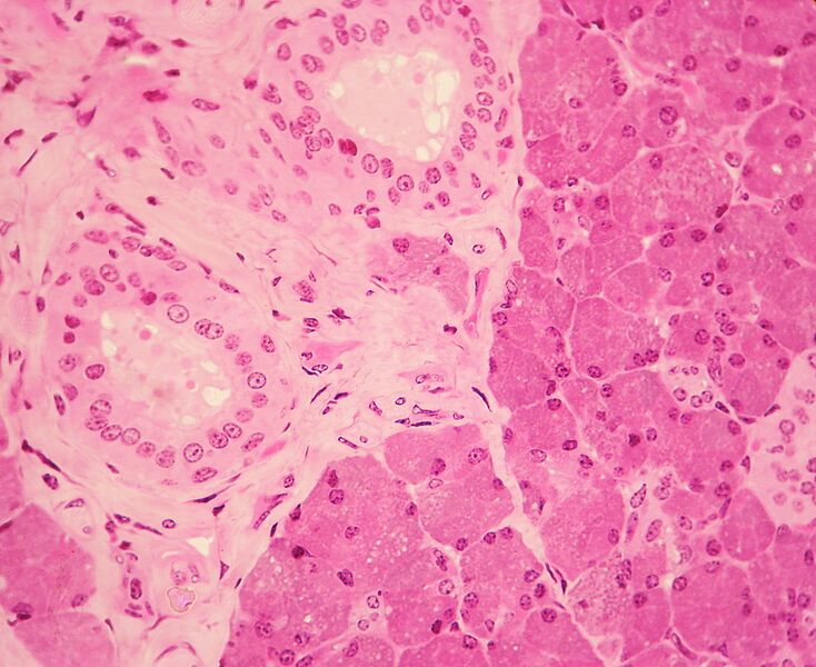 File:WVSOM Parotid Gland1.JPG
