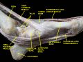 Extensor hallucis longus muscle