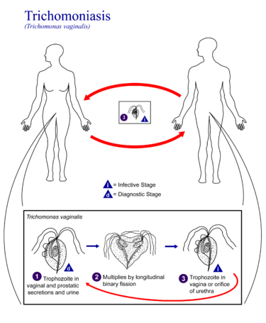 File:Trichomoniasis 01.png