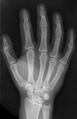 Skeleton of a human hand