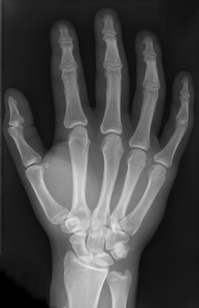 File:Handskelett.png
