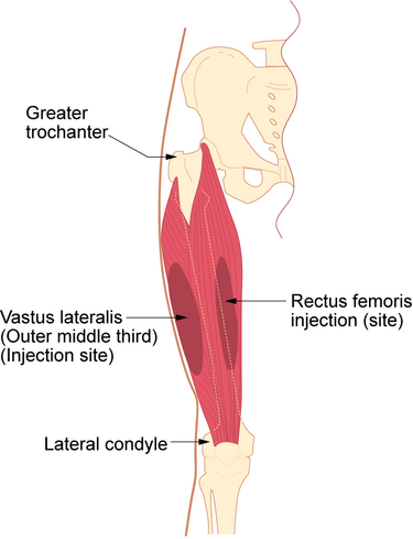 File:Im-vastus-lateralis.png