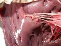 Papillary muscle