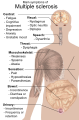 Thumbnail for version as of 00:59, 19 May 2026