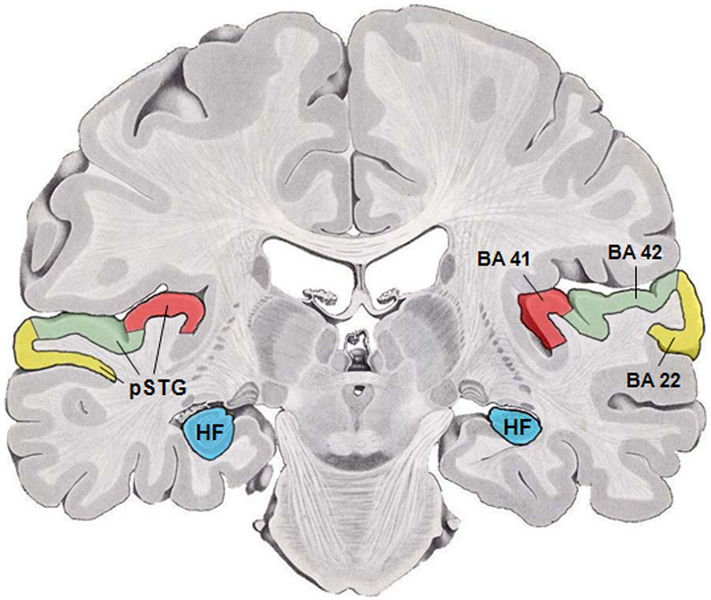 File:Human temporal lobe areas.png