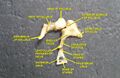 Malleus