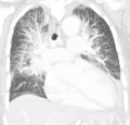 Thumbnail for version as of 02:10, 7 June 2026