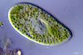Paramecium bursaria with zooxanthellae