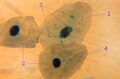 Chlamydia pneumoniae