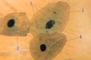 Chlamydia pneumoniae