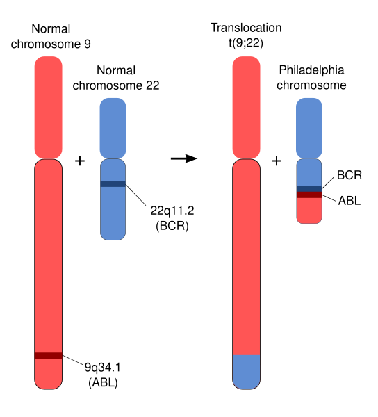 File:Schematic of the Philadelphia Chromosome.svg