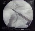 Instruments used in radiology