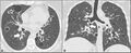 Thumbnail for version as of 03:35, 5 June 2026