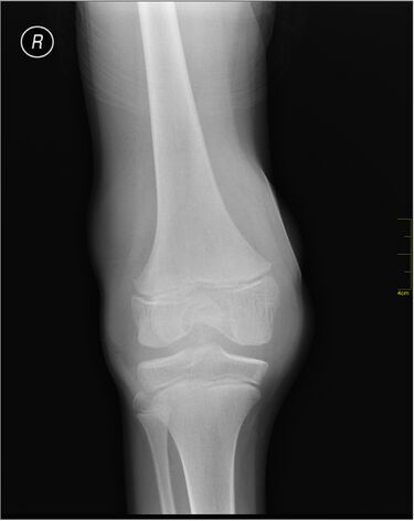 File:Medical X-Ray imaging JDH05 nevit.jpg
