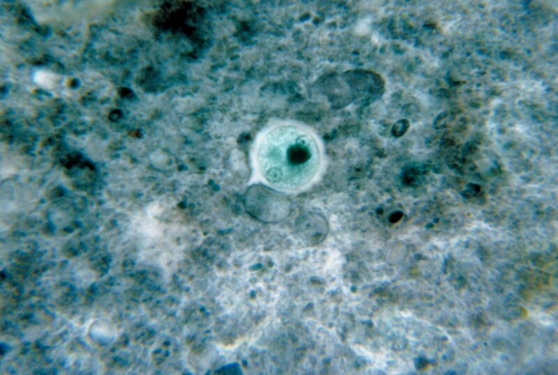 File:Entamoeba histolytica 01.jpg