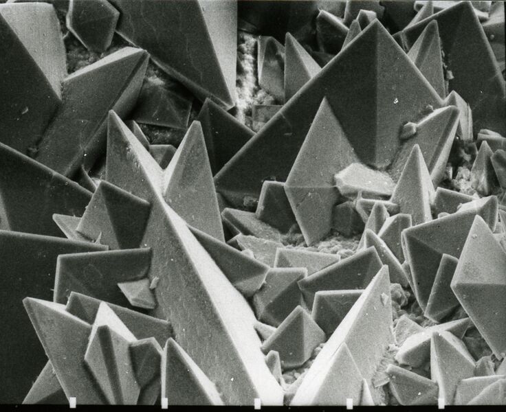 File:Surface of a kidney stone.jpg